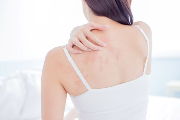 Can Eczema Be Cured?